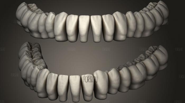 Azure Dental Library with Thimble Crowns3 3d stl модель для ЧПУ