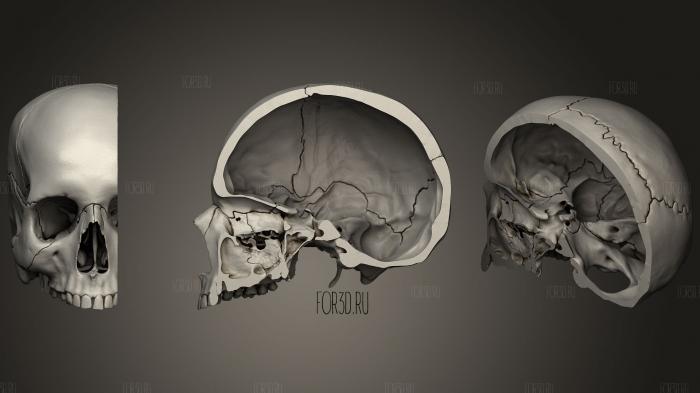 Cranial Base Inferior View