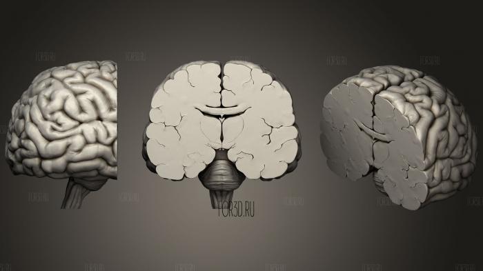 Корональный разрез глубоких структур головного мозга