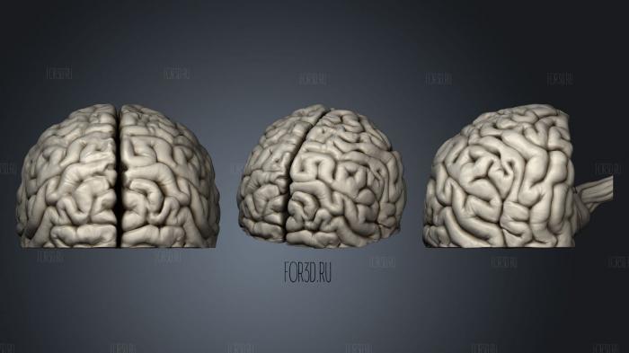 Корональный Разрез Глубоких структур головного мозга 3d stl модель для ЧПУ