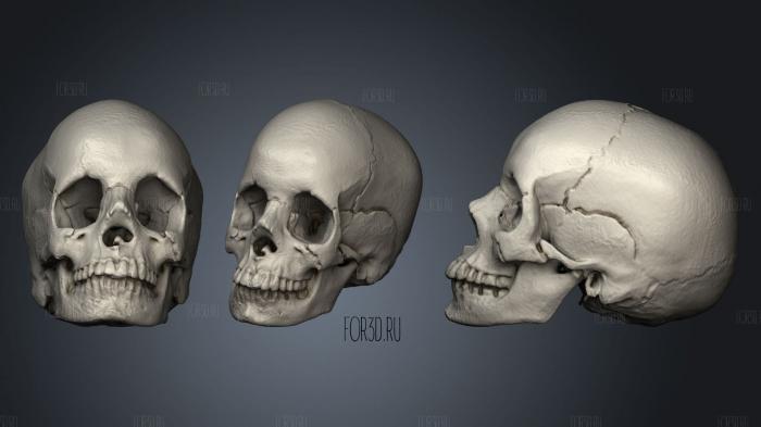Anatomical skull stl model for CNC