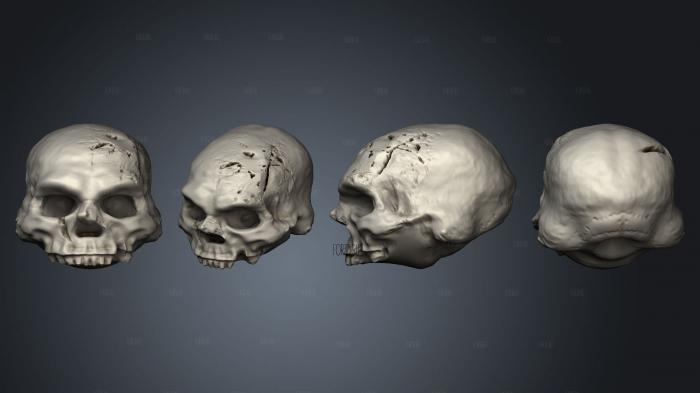 Stretch Goals Skulls Vol 2 dwarf skull B stl model for CNC