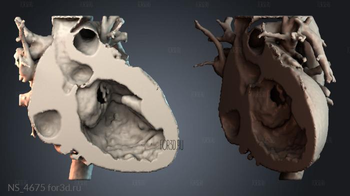 NS_4675 3d stl модель для ЧПУ