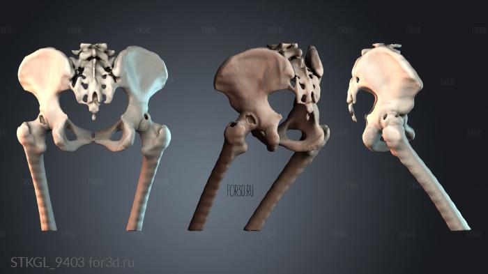 STKGL_9403 stl model for CNC