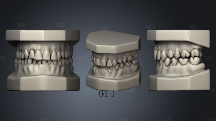 Teeth stl model for CNC